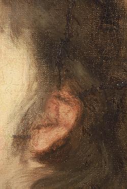 Click the image for a view of: Detail of boy's ear, before treatment